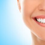 Laminating Your Teeth For Smile Enhancement Through Porcelain Veneers