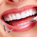 What Are Some Common Cosmetic Oral Procedures, and How Are They Beneficial?