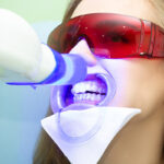 ZOOM Teeth Whitening: Say Goodbye to Stains and Hello to a Dazzling Smile